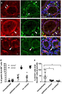 CD103 (αE Integrin) Undergoes Endosomal Trafficking in Human Dendritic Cells, but Does Not Mediate Epithelial Adhesion